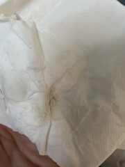 Could this be implantation bleeding 