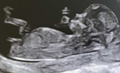 Due Jan 2023