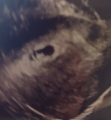 Does my ultrasound look like twins ?