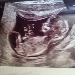 Due December 2022 thread 3