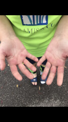 Does this sound like hand foot and mouth?