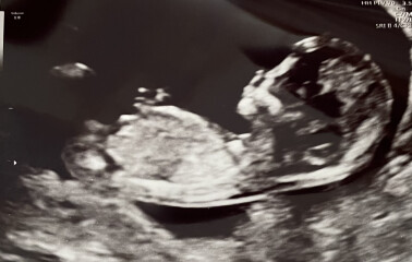 Due December 2022 thread 3