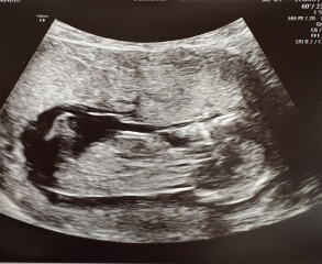 Temptation to find out gender! Help