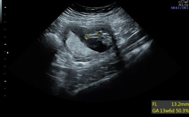 Due December 2022 thread 3
