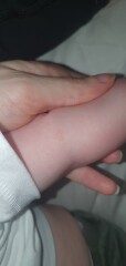 Ringworm?