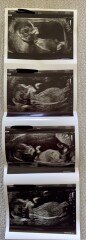 Gender Guesses?!!