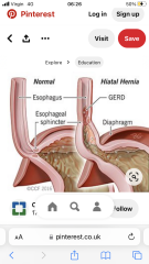 Ongoing centre chest pains, breathleness, upper back pain, been to A&E 3 times in 1 month 