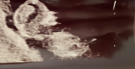 Due December 2022 thread 3