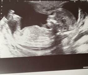 Boy or girl?! 14+1