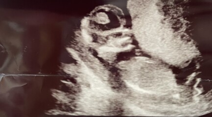 Due December 2022 thread 3