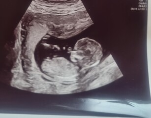 Due December 2022 thread 3