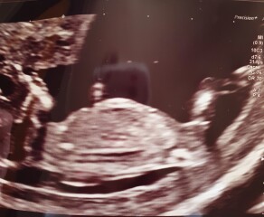 Scan- sex guesses 