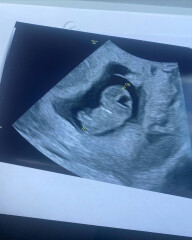 Due Jan 2023