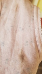 Brown Discharge at 5 weeks 4 days pregnant