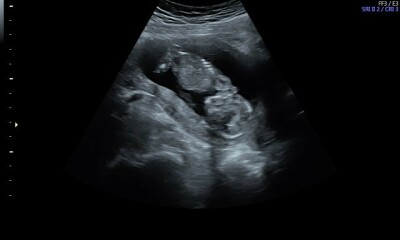 Due December 2022 thread 3