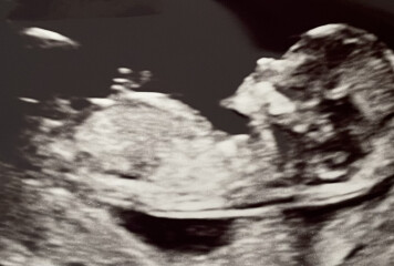 Due December 2022 thread 3