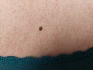 Mole