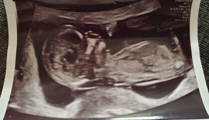 Due December 2022 thread 3