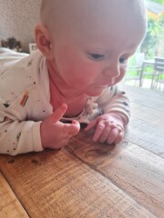 Baby's Skin is Red Raw