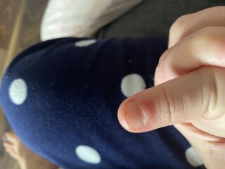 Sore thumb
