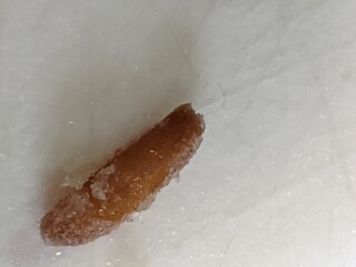 to ask if this is maggot or grain of rice?