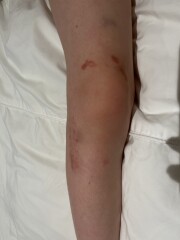 Any ideas about DDs weird rash? 