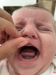 Tongue tie?