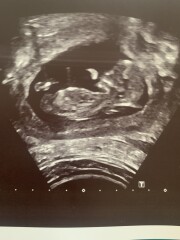 Boy or Girl? 
