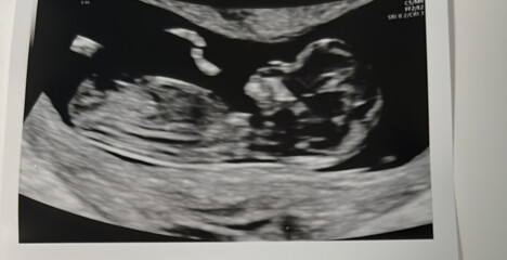 Due Jan 2023