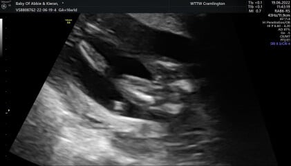 Gender guesses/nub theory? 
