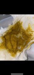 Sudden change in baby poo - jelly like green poo