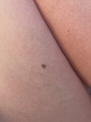 Mole