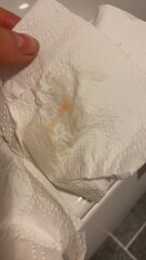 Mucus plug? Small red blood clots *tmi pic* 41 was tomorrow.