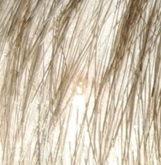 6yo grey hair and mole on scalp -should I be worried 