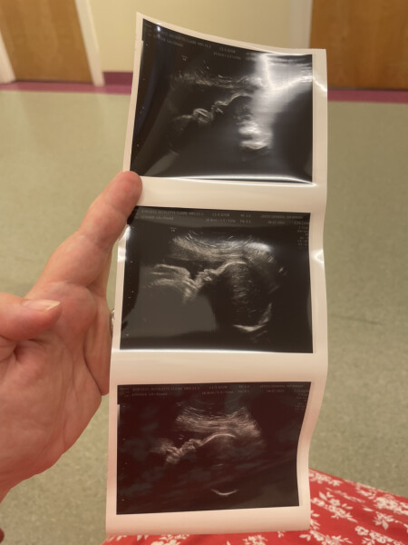 Due September 2022 (Thread 7!)