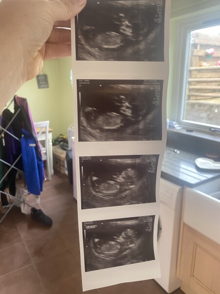 Boy or girl?