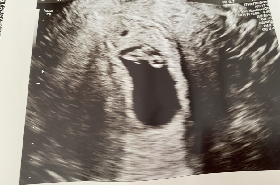 IVFers Due Mar & Apr 2023