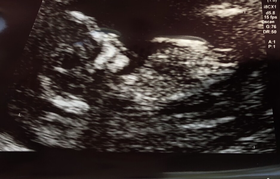 Due Jan 2023