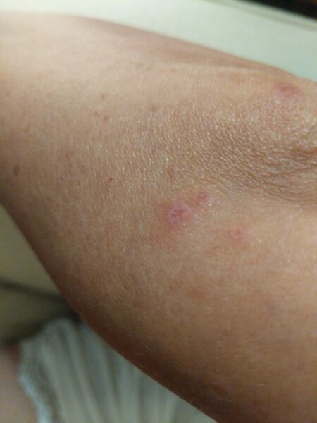 Are bed bugs actually real?
