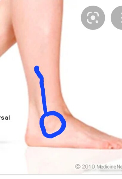 What is this pain?