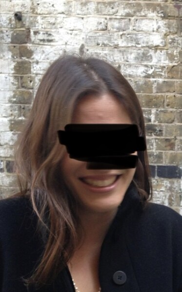 Receding hairline - to fringe or not to fringe 