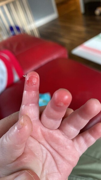 Incident at Nursery, how much do I lose my shit over it?