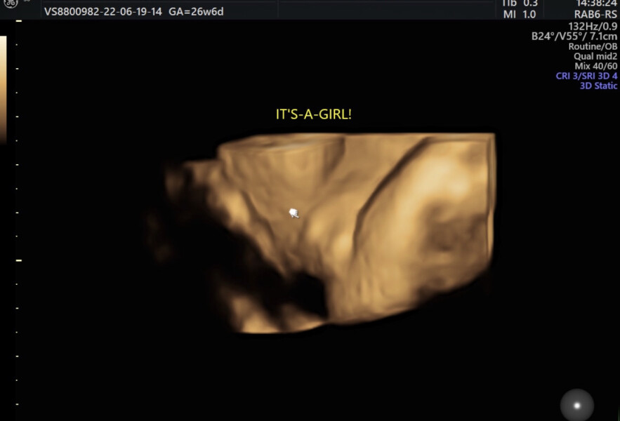 Due September 2022 (Thread 7!)