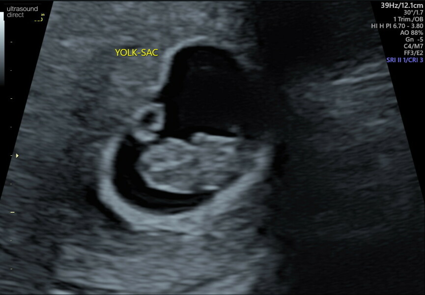 Due February 2023 ❤️💙💛💖