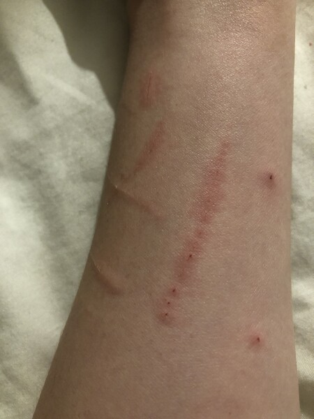 Usually gentle cat has suddenly attacked 