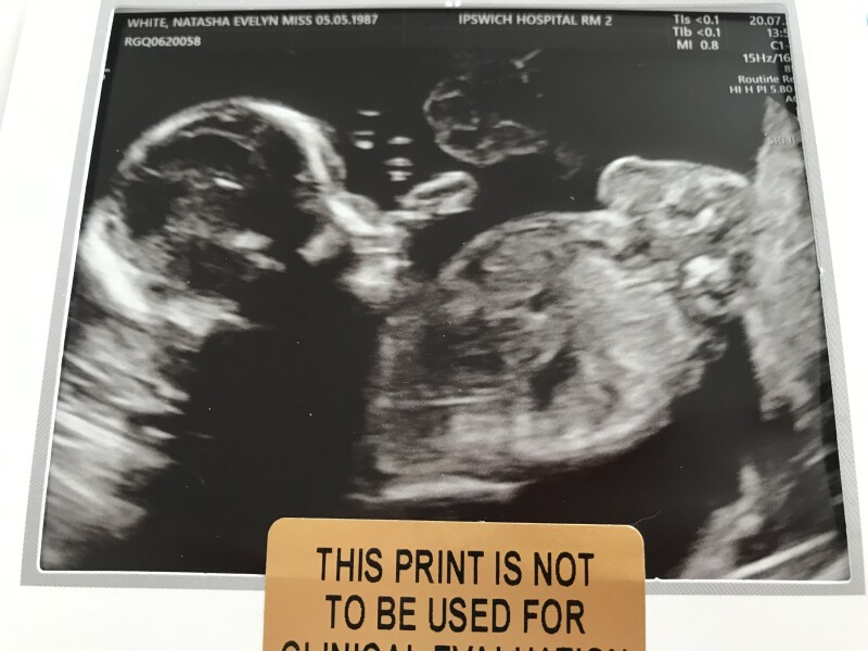Due December 2022 (thread 4)