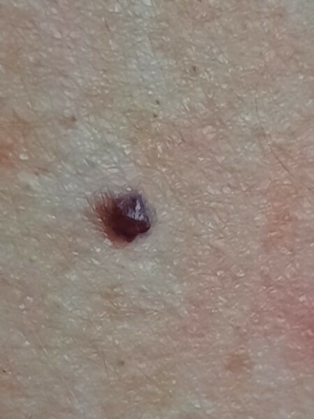 What is this growth (photos)