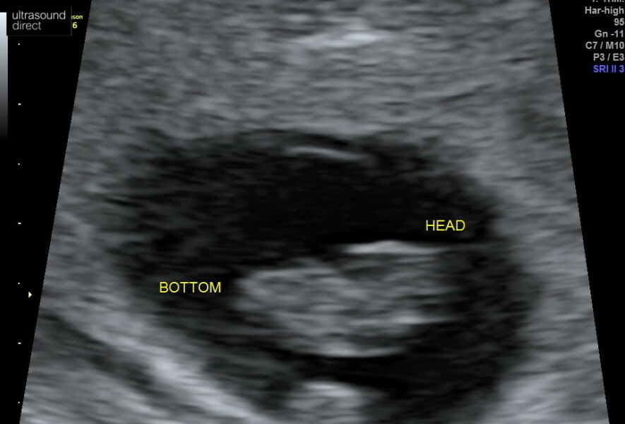 8 weeks on Monday and booked a scan