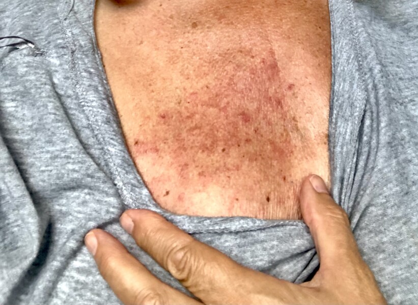 Cancer Support Thread 83 - Here comes the sun (hopefully) 