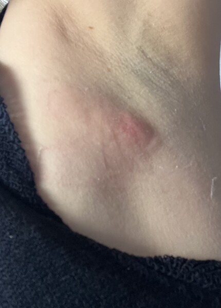 Is this a boil?! Help! 